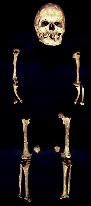 L'enterrament de Romito 2. Font: "Dwarfism in an adolescent from the Italian late Upper Paleolithic".